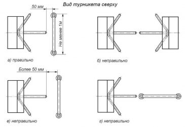 Установка турникетов нормы